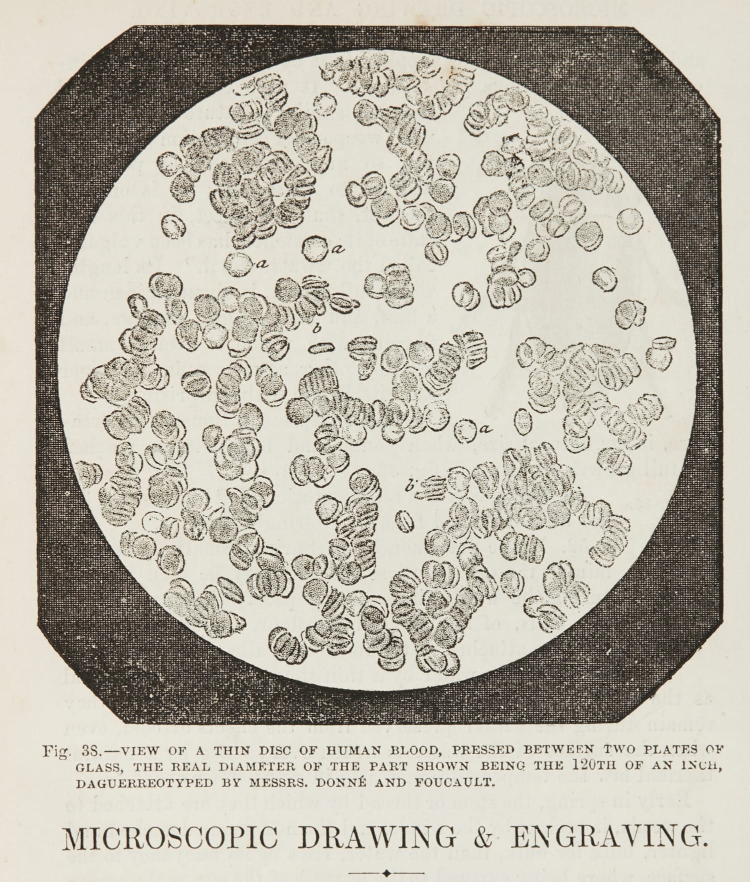 The First Photomicrograph of a Flea – Alfred Donné, 1844